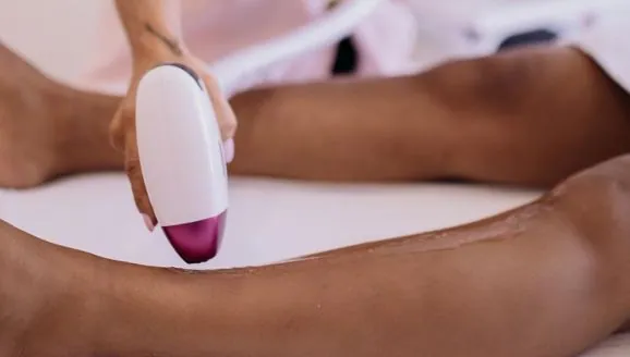 Depilação a laser profissional