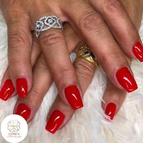 Resultado de tratamento estético na Clínica À Flor da Pele – resultado 12