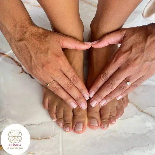 Resultado de tratamento estético na Clínica À Flor da Pele – resultado 18